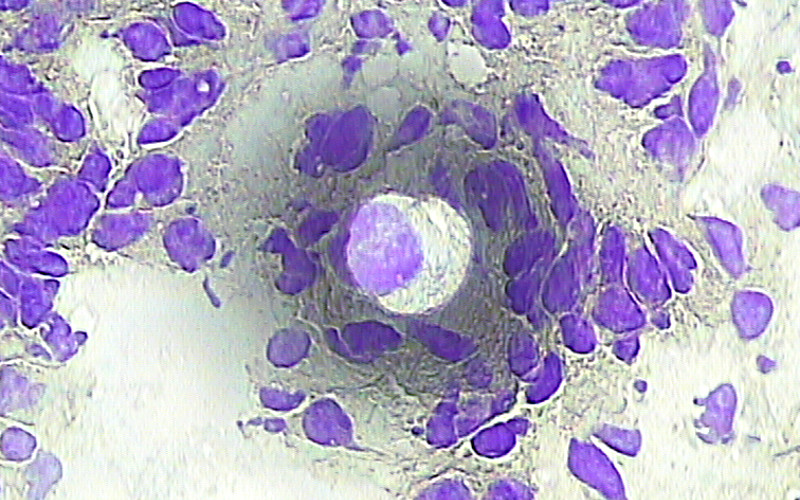 MicroGénomique et single cell